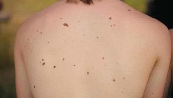 Kenali Tanda Lahir Orang Miskin Menurut Primbon Jawa, Apakah ada di Anda? 