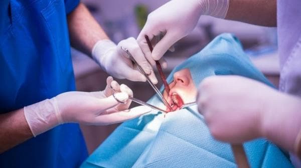 Cek Harga Operasi Gigi Bungsu, Apakah Ditanggung BPJS Kesehatan?