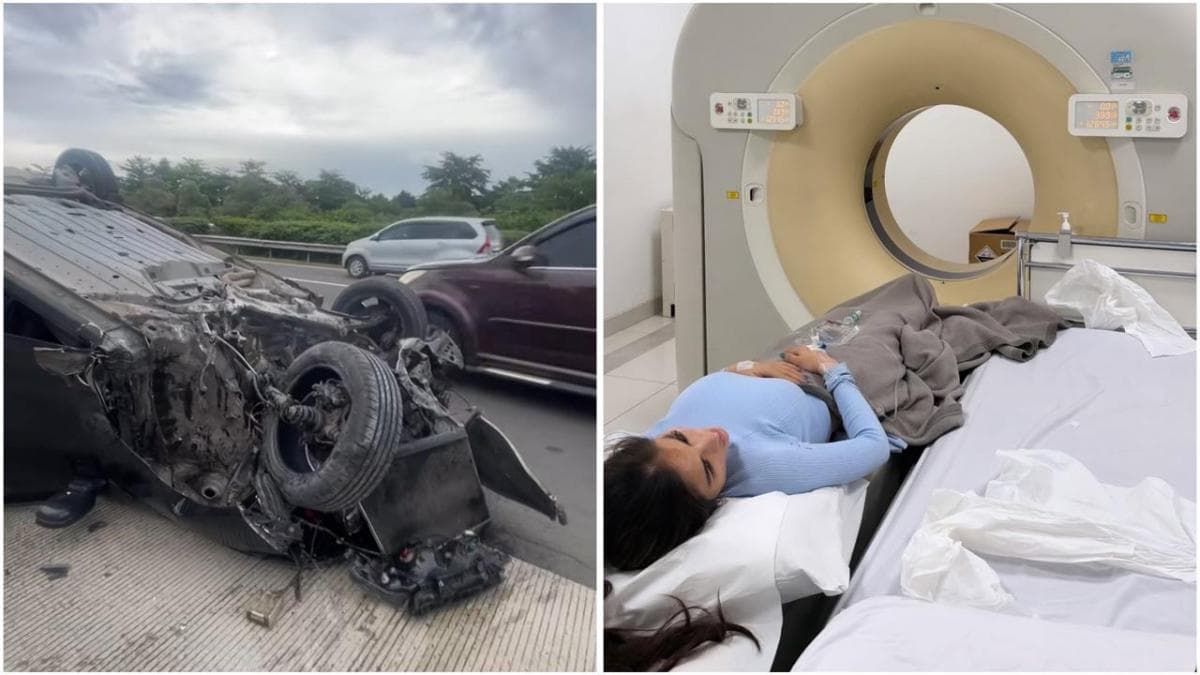 Kronologi Lengkap Diva Siregar Kecelakaan Hebat, Mobil Terbalik di Jalan Tol!