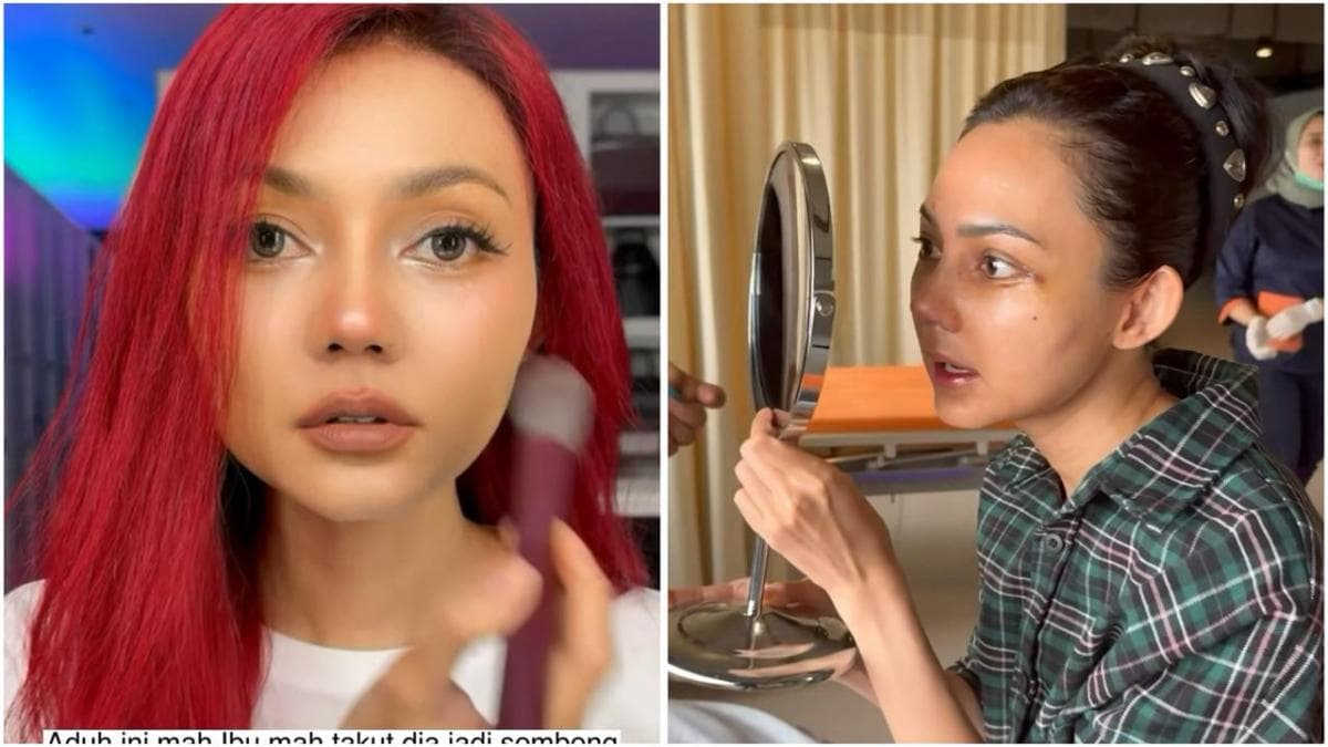 Viral Rina Nose Pamer Hidung Baru setelah Oplas, Ini Fotonya! Viral Rina Nose Pamer Hidung Baru setelah Oplas, Ini Fotonya!