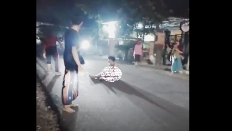 Mengerikan! Tangan Bocah SMP di Bangkalan Hancur akibat Ledakan Petasan