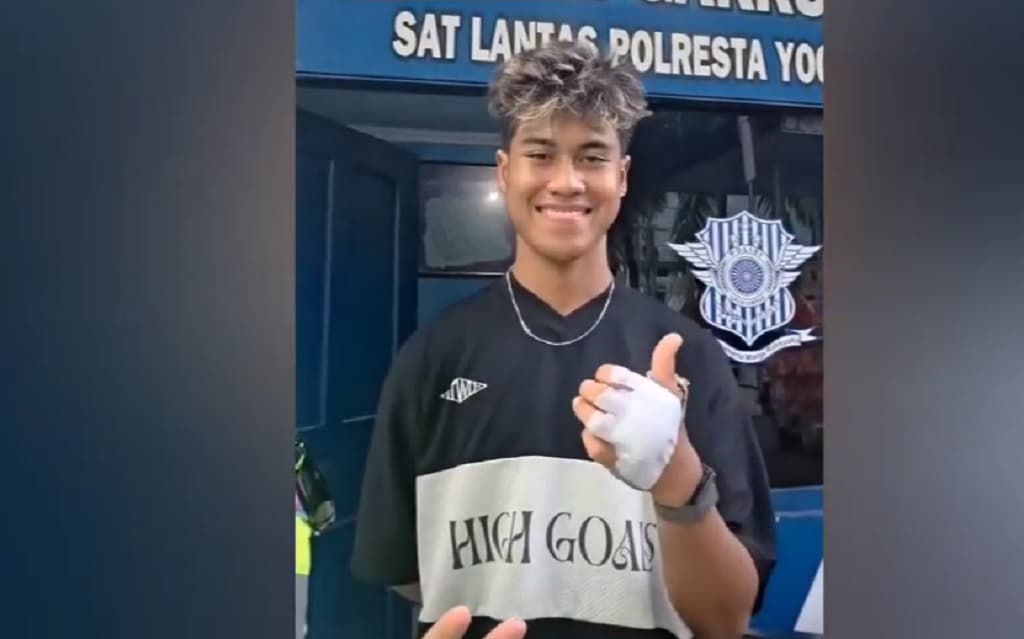 Viral Pembalap Muda Nasional Aldi Satya jadi Korban Tabrak Lari di Jogja