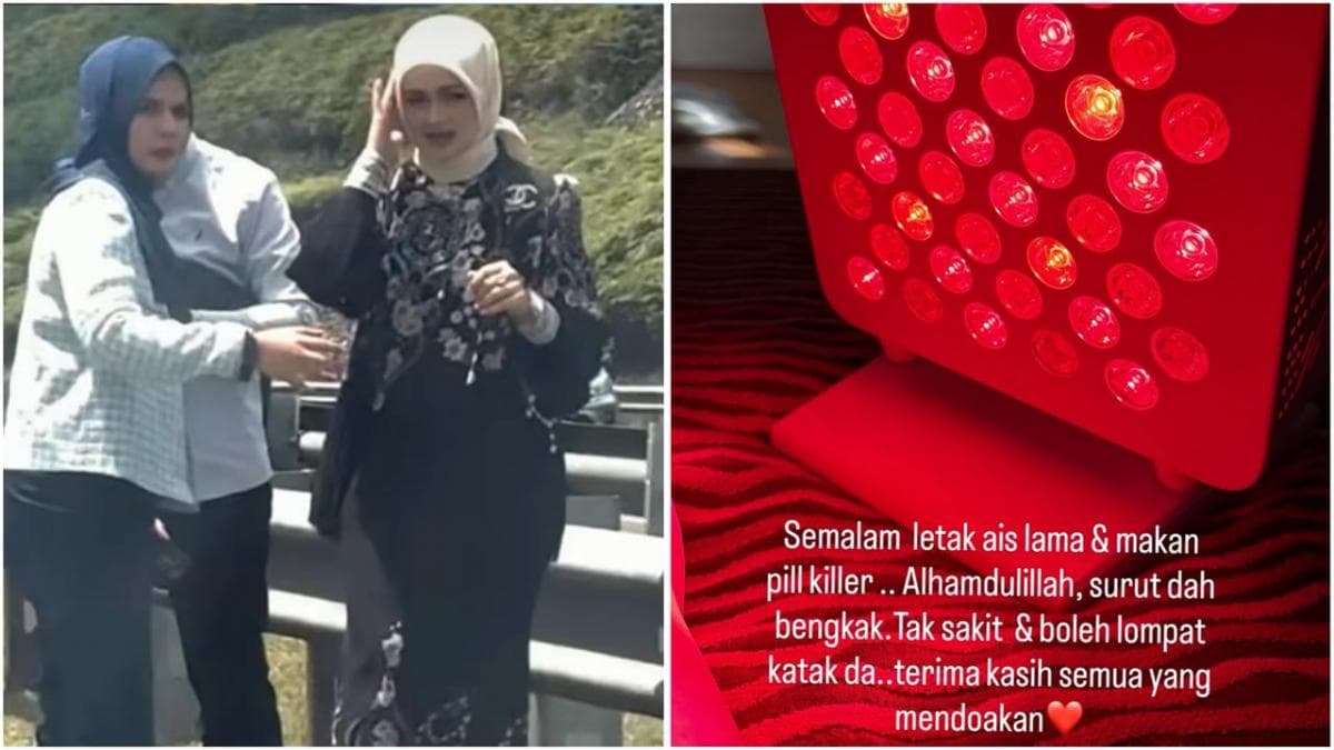 Kondisi Terkini Siti Nurhaliza usai Kecelakaan Mobil, Cedera hingga Minum Pain Killer