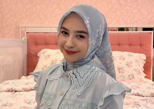 Ria Ricis Akui Oplas Hidung, Ini Pengakuannya