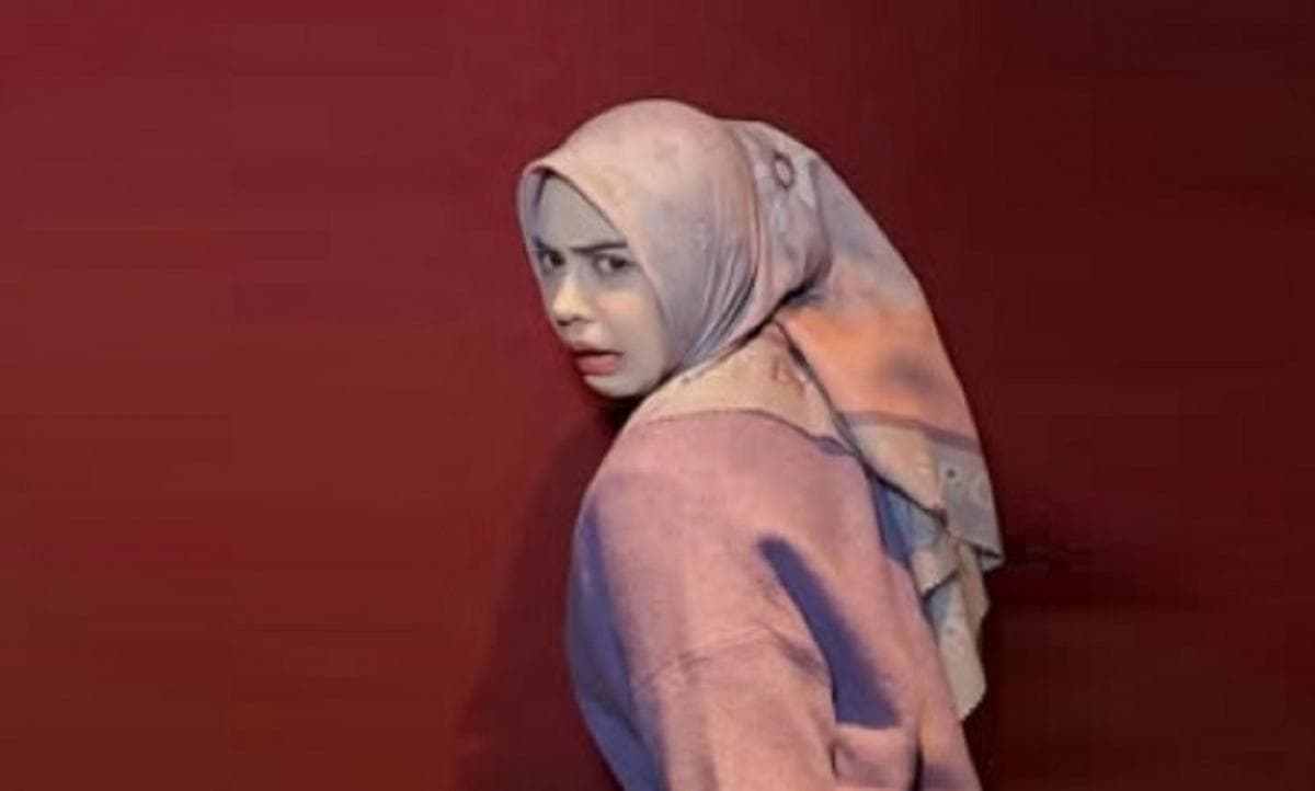 Ria Ricis Operasi Hidung Pakai Tulang Iga karena Belok