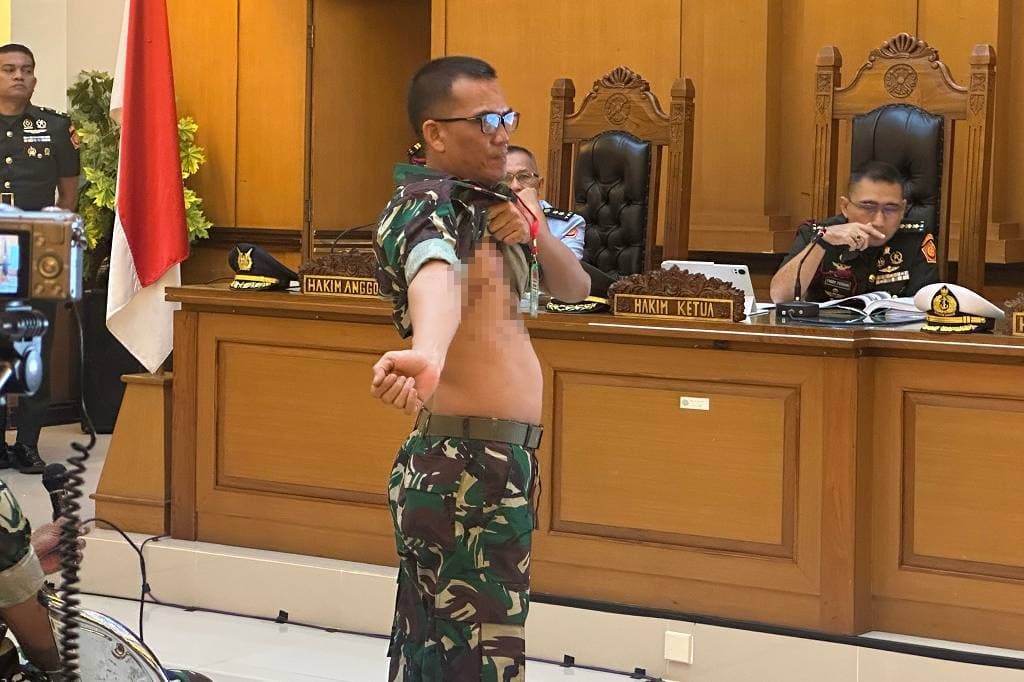 Prajurit TNI Tunjukkan Bekas Luka usai Terciprat saat Siram Air Keras ke Andrie Yunus