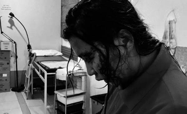 Wanita Muda di Bekasi Babak Belur Berlumuran Darah Dihajar Bekas Pacar, Sempat Dilempar Frozen Food