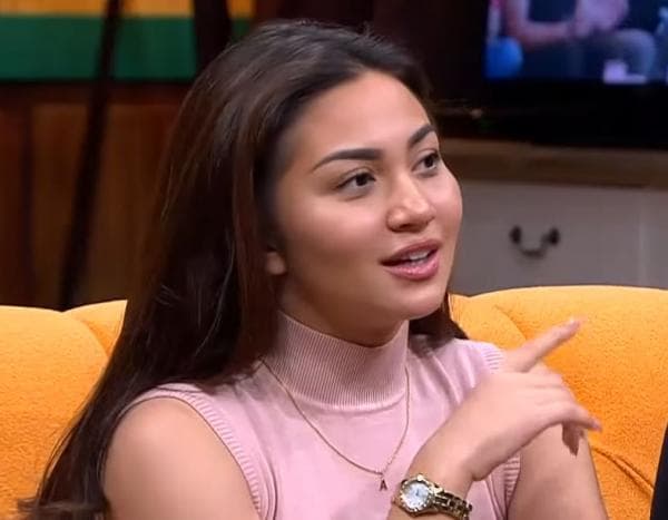 Inilah Selebritis Pemilik Bibir Seksi, Salah Satunya Kini di Los Angeles