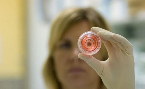 Awal Mula Donor Mata di Indonesia, Dapat Sumbangan Kornea dari Sri Lanka