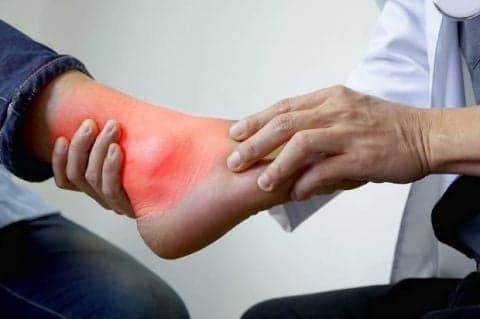 Cara Atasi Asam Urat dan Kolesterol Pakai Tumbuhan, Yuk Coba! Cara Atasi Asam Urat dan Kolesterol Pakai Tumbuhan, Yuk Coba!