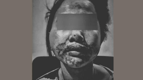 Suami Hajar Istri Sedang Hamil 4 Bulan hingga Babak Belur, Ternyata Pecandu Narkoba