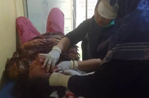 Diserempet Inova Warga Caringin Labuan Alami Luka Berat di Wajah