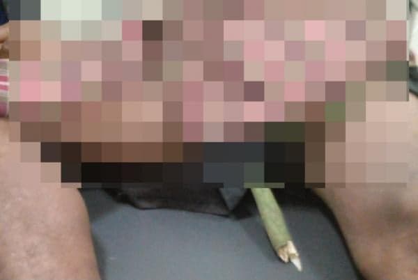 Pemburu Madu Hutan di Ciamis Jatuh dari Pohon, Pangkal Paha Tertusuk Kayu Runcing Pemburu Madu Hutan di Ciamis Jatuh dari Pohon, Pangkal Paha Tertusuk Kayu Runcing