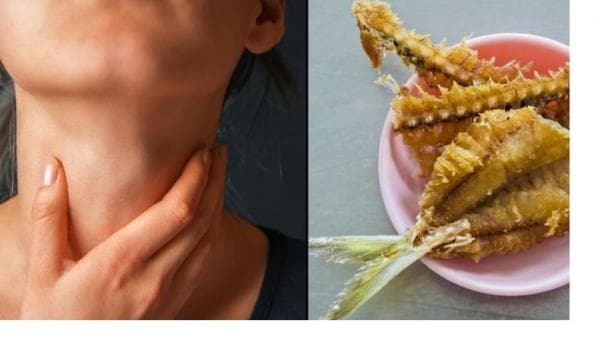 Duri Ikan Nyangkut di Tenggorokan, Begini 5 Cara Mudah Menghilangkannya