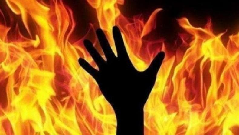 Santri yang Dibakar Senior di Pasuruan Luka Bakar 65 Persen, Begini Kondisinya