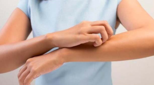 Cara Mengatasi Kulit Kaki Kering dan Bersisik dan Penyebabnya, Yuk Cari Tahu