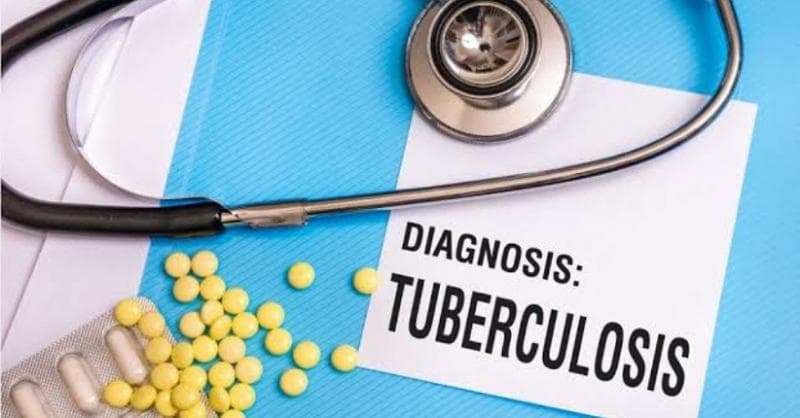 Fakta tentang Tuberkulosis di Indonesia, Kasus Tertinggi di Usia Produktif