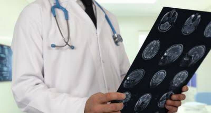 Jangan Sepelekan Stroke, Kenali Masa Golden Period dan Penanganannya!