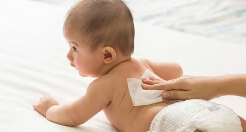 Penting Diketahui, Kiat Menjaga Kesehatan Kulit Bayi dari Risiko Ruam