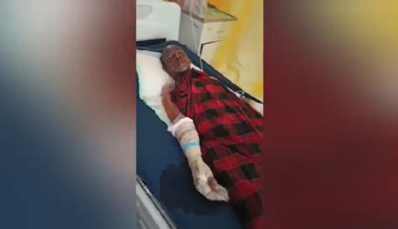 Tabung Elpiji Meledak di Banyuwangi, 4 Orang Sekeluarga Luka Bakar Serius