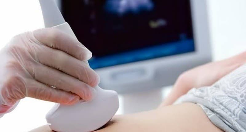 5 Artis Hamil di Usia 40an, Nomor 3 Sempat Koma 2 Hari