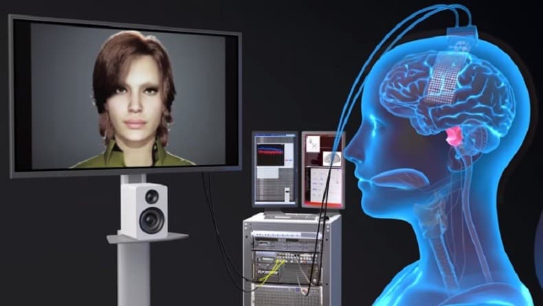 Implan Otak Bikin Perempuan Ini Bisa Berbicara Lagi, Kok Bisa?