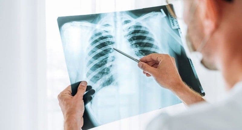 Waspada Pneumonia akibat Polusi Udara, Kenali Cara Pencegahannya!