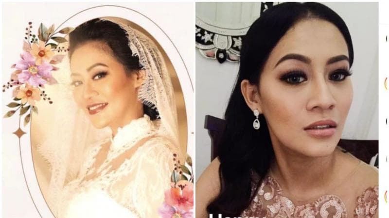 Apa Itu Liposuction, Prosedur Sedot Lemak yang Dilakukan Nanie Darham sebelum Meninggal