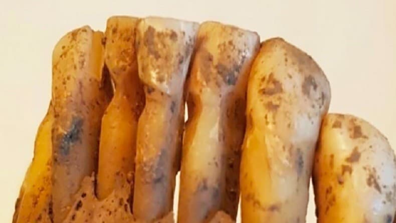 Gak Nyangka, Bangsa Viking Ternyata Punya Ilmu Kedokteraan Gigi Maju 