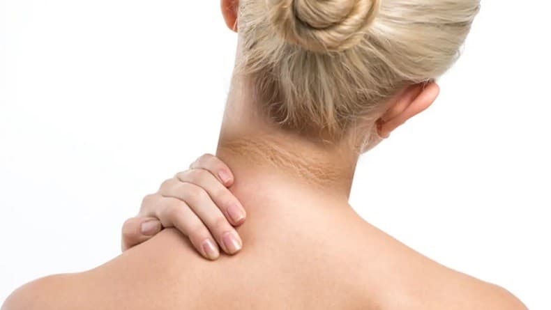 Bukan Daki, Ini Penyebab Leher Menghitam dan Cara Mengatasinya