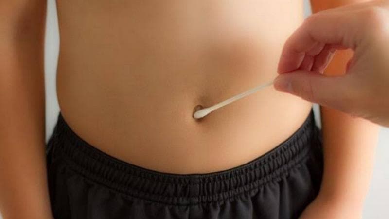 Pusar Apakah Perlu Dibersihkan? Dokter Ungkap Fakta Ini