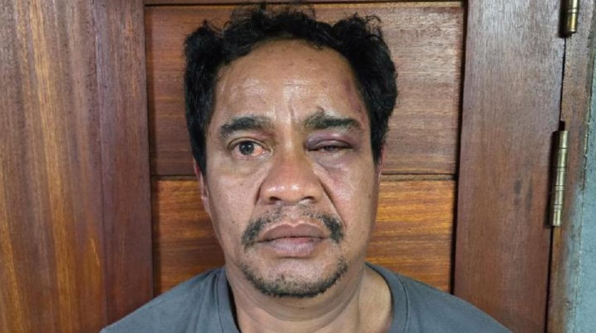 Boy Bandar Narkoba Penyetor Uang ke Polisi di Bima Ditangkap, Nih Penampakannya!