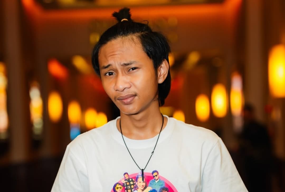 Kondisi Terkini Fajar Sadboy Usai Kecelakaan Motor: Tangan Retak, Kuku Copot