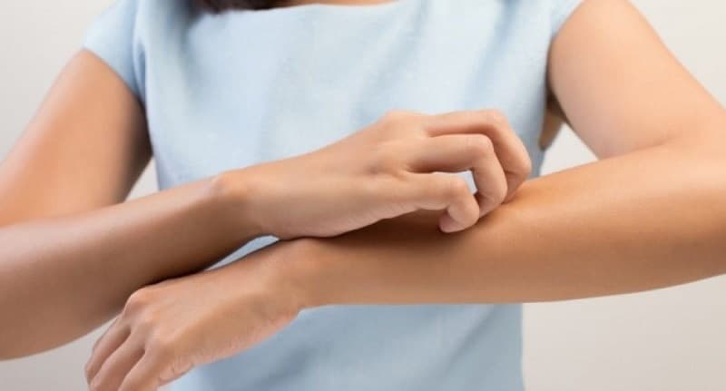 Kulit Bentol-Bentol Dibarengi Sesak Napas? Waspadai Syok Anafilaktik