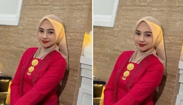 Operasi Hidung, Ria Ricis: Gak Boleh Lagi Panas-panasan