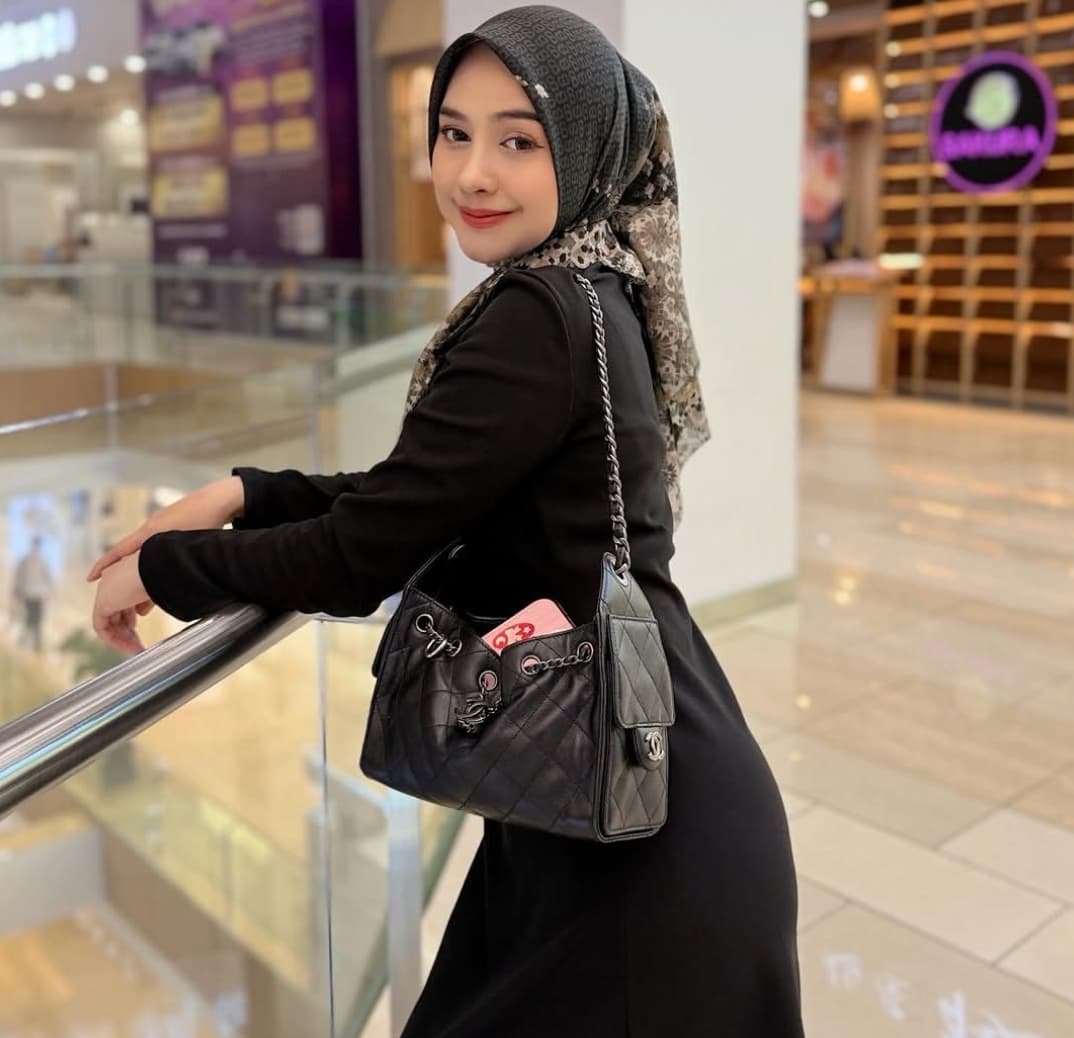 Ria Ricis Operasi Hidung Pakai Tulang Iga: Tadinya Agak Belok