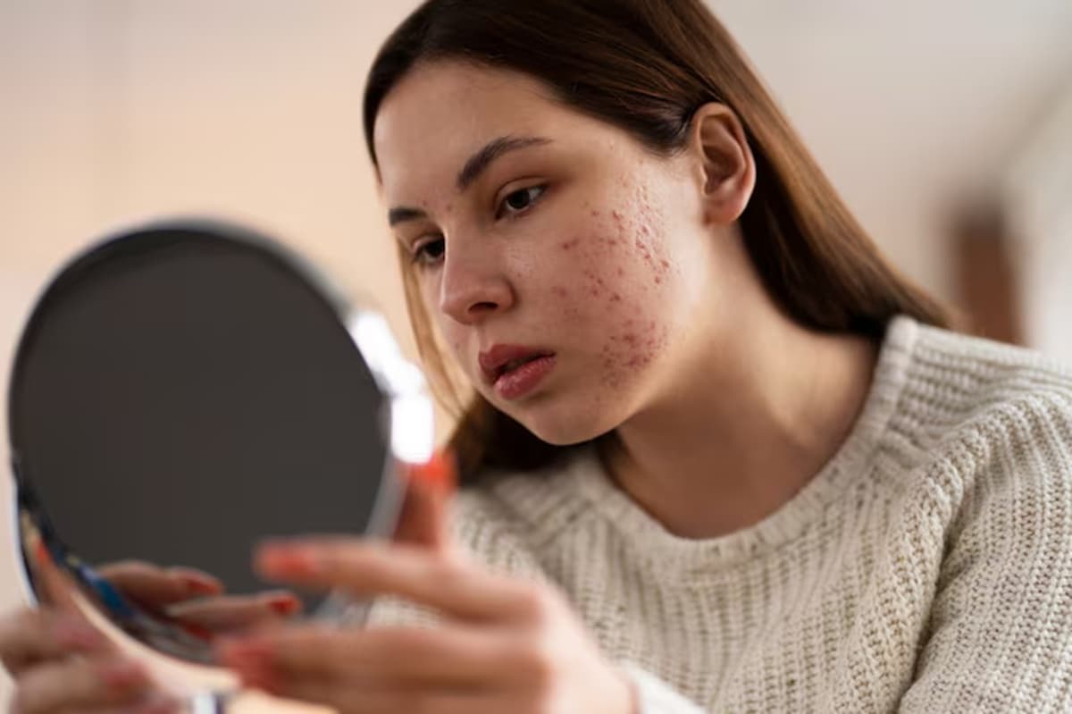 Mitos atau Fakta: Berhenti Pakai Skincare Abal-Abal, Kulit Otomatis Kembali Normal?