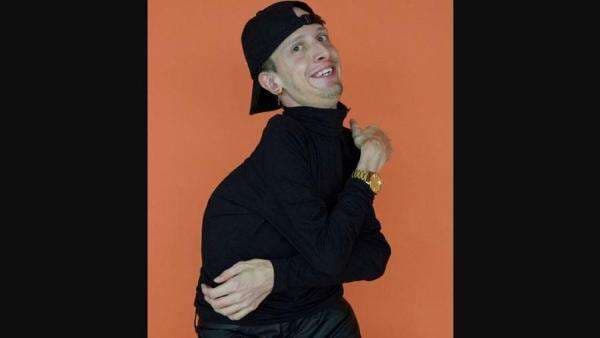 YouTuber Alami Sindrom Langka Tak Dapat Disembuhkan, Hanya Ada 700 Kasus di Dunia