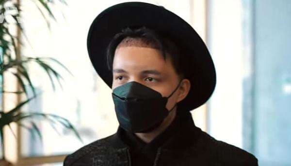 Atta Halilintar Jalani Transplantasi Rambut karena Tak PD Punya Jidat Lebar, Ini Potretnya