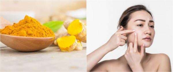 10 Manfaat kunyit untuk wajah, mampu atasi jerawat