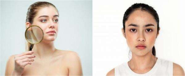 9 Rekomendasi skincare kulit kusam, wajah cerah alami