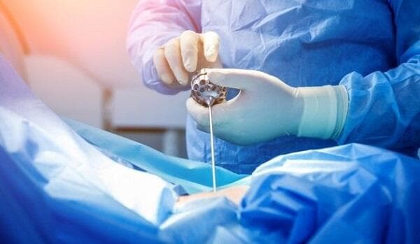 Mengenal Metode BESS untuk Pengobatan Nyeri Tulang Belakang, Minim Rasa Sakit!