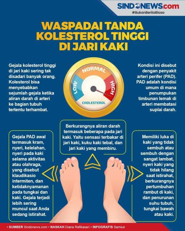 Waspadai Tanda Kolesterol Tinggi di Jari Kaki Anda