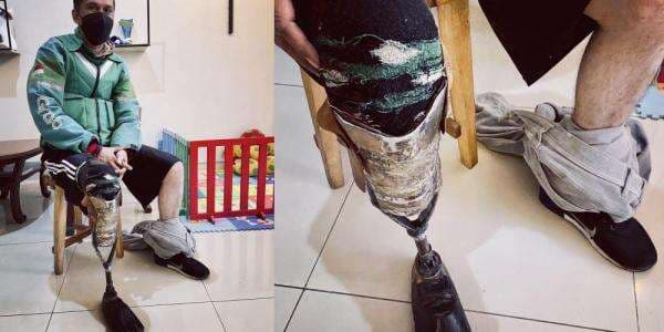 Fakta-fakta Kisah Haru Kaki Palsu dari Knalpot Milik Driver Ojol, Bikin Sendiri Gaes!