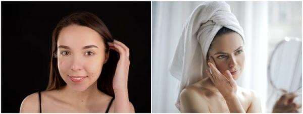 Rekomendasi 9 skincare menghilangkan milia, harga mulai Rp 20 ribu