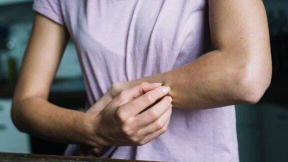 Tanda Penyakit Ginjal juga Bisa Muncul di Kulit, Perhatikan Begini Cirinya...