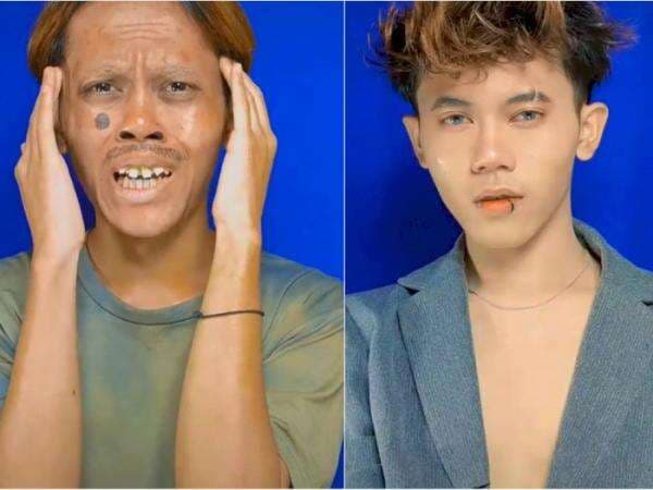 Nyaris Mustahil! Dari Culun, Pria Ini Bermetamorfosis Jadi Pria Tampan Idaman Wanita