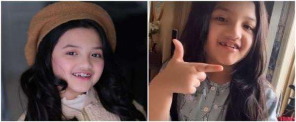 Pasang kawat gigi, ini 7 potret terbaru Arsy Hermansyah