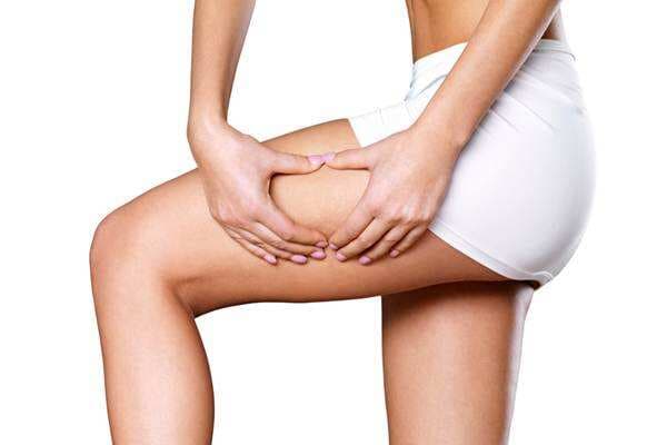 Gejala, Penyebab dan Cara Mengatasi Selulit, Musuhnya Kaum Perempuan