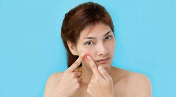 Benarkah Jatuh Cinta Picu Jerawat Muncul?